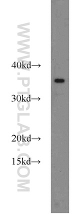 CHMP2B Antibody in Western Blot (WB)