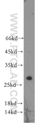 CHMP2B Antibody in Western Blot (WB)