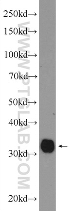 CHMP2B Antibody in Western Blot (WB)