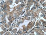 PLAA Antibody in Immunohistochemistry (Paraffin) (IHC (P))