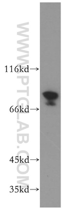 PLAA Antibody in Western Blot (WB)