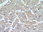 RRAS2 Antibody in Immunohistochemistry (Paraffin) (IHC (P))