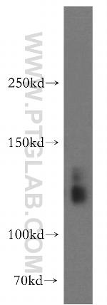 SLC4A8 Antibody in Western Blot (WB)