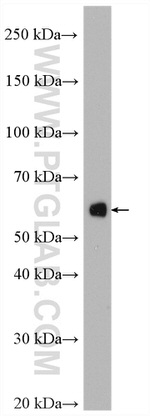 Amylase alpha Antibody in Western Blot (WB)