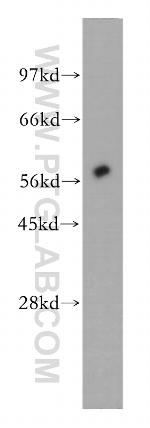 Amylase alpha Antibody in Western Blot (WB)