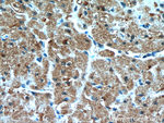 PIP5K1B Antibody in Immunohistochemistry (Paraffin) (IHC (P))