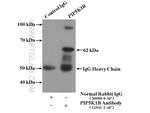 PIP5K1B Antibody in Immunoprecipitation (IP)