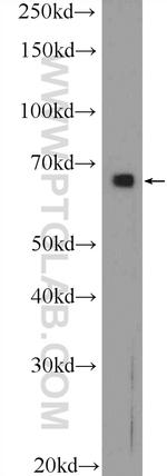 Annexin VI Antibody in Western Blot (WB)