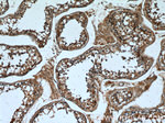 Annexin VI Antibody in Immunohistochemistry (Paraffin) (IHC (P))