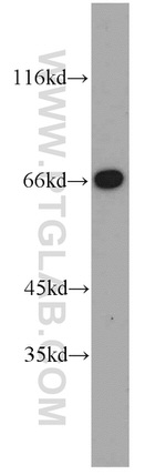 Annexin VI Antibody in Western Blot (WB)