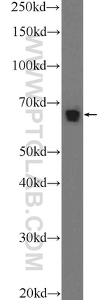 Annexin VI Antibody in Western Blot (WB)