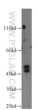 TRIM31 Antibody in Western Blot (WB)