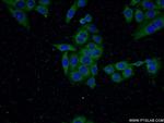 SQLE Antibody in Immunocytochemistry (ICC/IF)