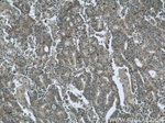 SQLE Antibody in Immunohistochemistry (Paraffin) (IHC (P))