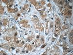 SQLE Antibody in Immunohistochemistry (Paraffin) (IHC (P))