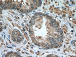 SQLE Antibody in Immunohistochemistry (Paraffin) (IHC (P))