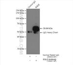 SQLE Antibody in Immunoprecipitation (IP)