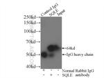 SQLE Antibody in Immunoprecipitation (IP)