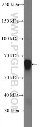 SQLE Antibody in Western Blot (WB)