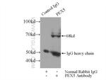 PEX5 Antibody in Immunoprecipitation (IP)