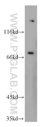 PEX5 Antibody in Western Blot (WB)