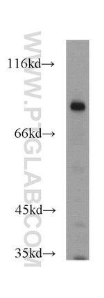 PEX5 Antibody in Western Blot (WB)