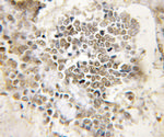 PER3 Antibody in Immunohistochemistry (Paraffin) (IHC (P))