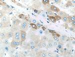 Factor XII Antibody in Immunohistochemistry (Paraffin) (IHC (P))