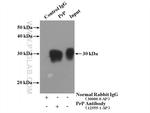 PrP Antibody in Immunoprecipitation (IP)