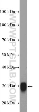 PrP Antibody in Western Blot (WB)