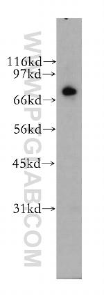 RAPGEF5 Antibody in Western Blot (WB)