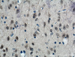 PRMT8 Antibody in Immunohistochemistry (Paraffin) (IHC (P))