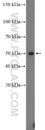 PRMT8 Antibody in Western Blot (WB)