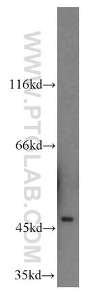 Neuroserpin Antibody in Western Blot (WB)