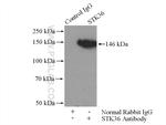 STK36 Antibody in Immunoprecipitation (IP)