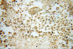 FUT8 Antibody in Immunohistochemistry (Paraffin) (IHC (P))