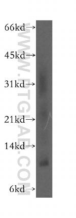 SELK Antibody in Western Blot (WB)