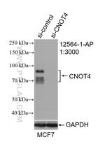 CNOT4 Antibody in Western Blot (WB)