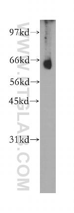 CNOT4 Antibody in Western Blot (WB)