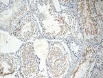 ROPN1L Antibody in Immunohistochemistry (Paraffin) (IHC (P))