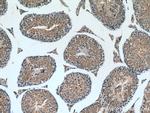 ROPN1L Antibody in Immunohistochemistry (Paraffin) (IHC (P))