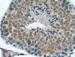 ROPN1L Antibody in Immunohistochemistry (Paraffin) (IHC (P))