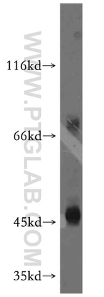 CD84 Antibody in Western Blot (WB)