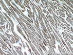 AMPK gamma2 Antibody in Immunohistochemistry (Paraffin) (IHC (P))