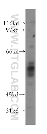 AMPK gamma2 Antibody in Western Blot (WB)