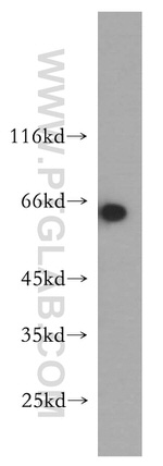 AMPK gamma2 Antibody in Western Blot (WB)