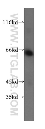 AMPK gamma2 Antibody in Western Blot (WB)