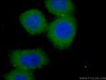 SCFD1 Antibody in Immunocytochemistry (ICC/IF)