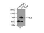 SCFD1 Antibody in Immunoprecipitation (IP)