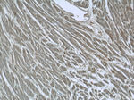 SMAD2 Antibody in Immunohistochemistry (Paraffin) (IHC (P))